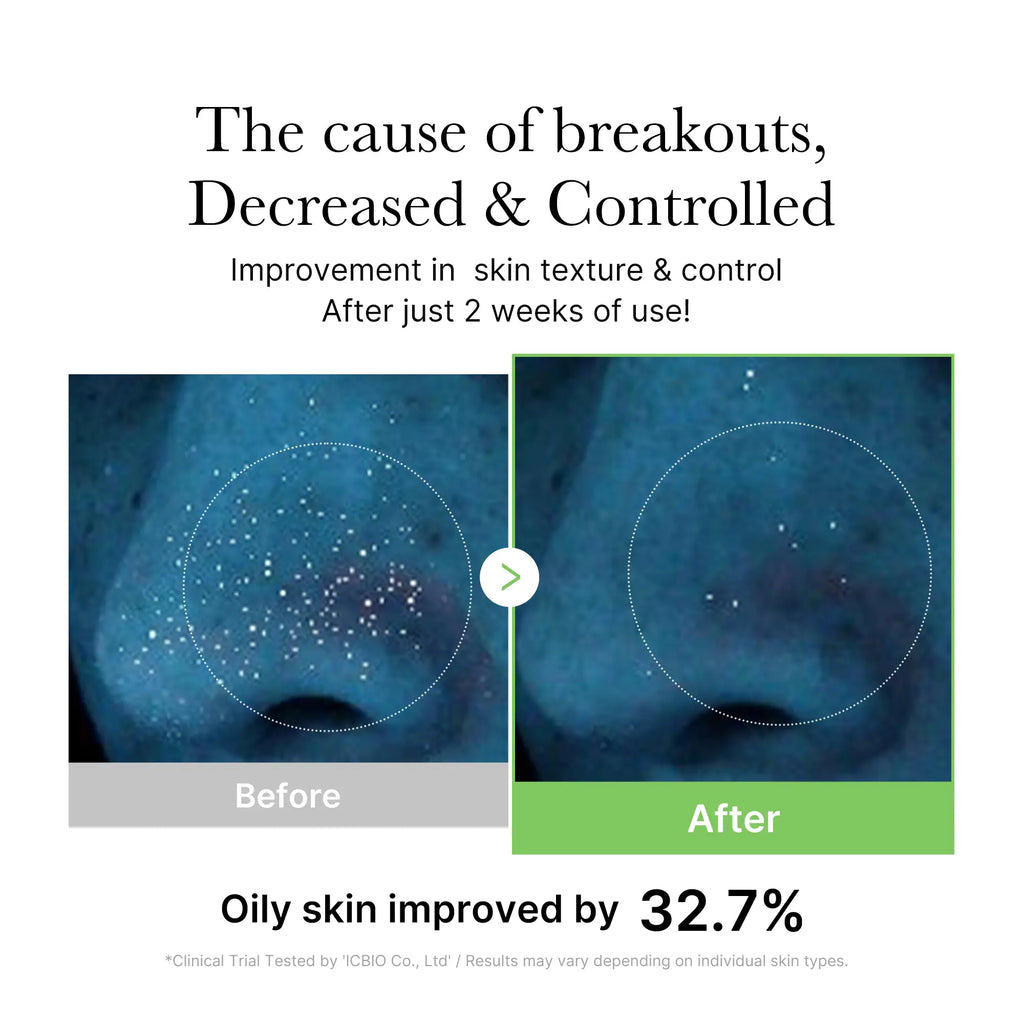 [Official Shop] Exosome Cica Toner | Daily Soothing Toner with Exosome Cica, Heartleaf, Tea Tree | Korean Skin Care for Stressed Skin